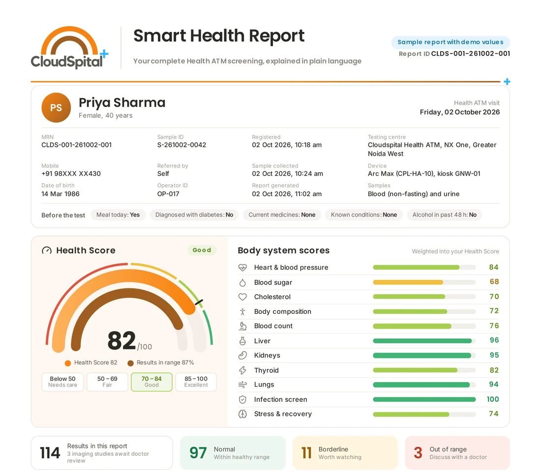 Sample Cloudspital Smart Health Report: a health score of 82 out of 100, scores for eleven body systems and counts of normal, borderline and out-of-range results, with demo values